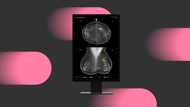 루닛의 의료진과 AI(인공지능)간 상호작용에 관한 연구 결과가 북미영상의학회(RSNA)가 발행하는 영상의학 학술지 ‘Radiology(IF 12.1)’에 게재됐다. /루닛