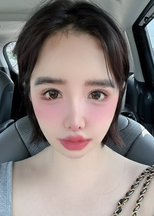 박봄 소셜미디어