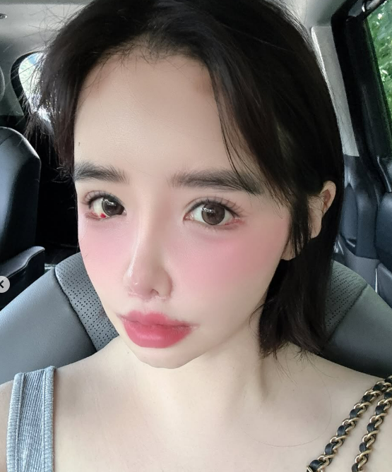 박봄 소셜미디어